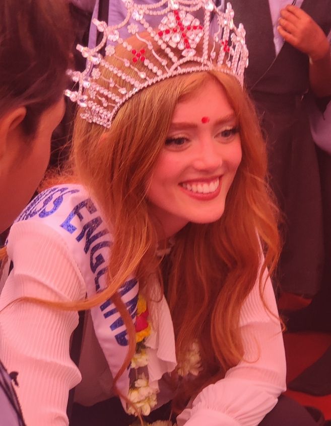 Model Competes in Miss Rajasthan Pageant with Leg Injury